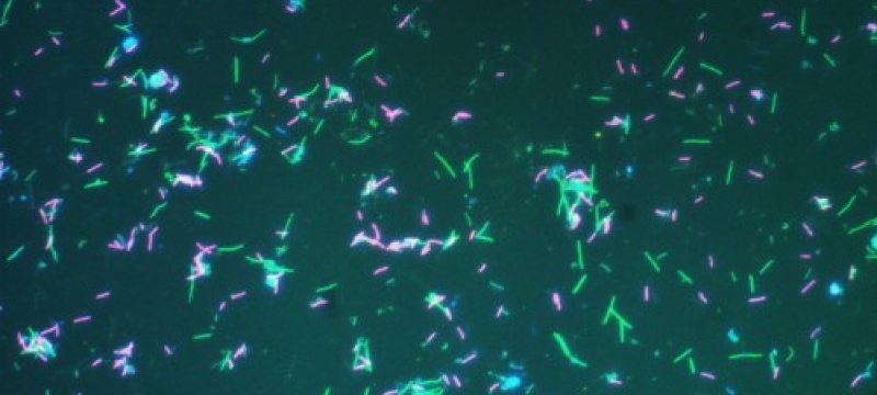 photo of pink and green bacteria